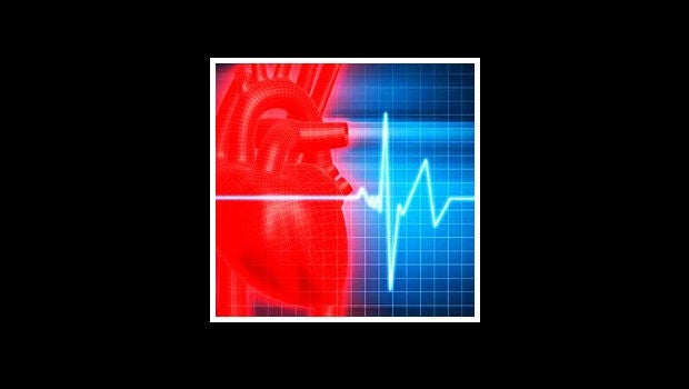 ​NHCS introduces a new kind of defibrillator for heart patients