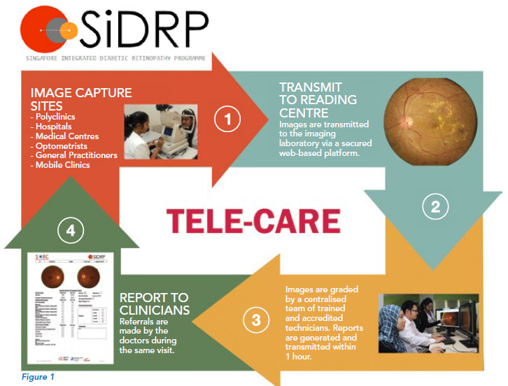 Singapore Integrated Diabetic Retinopathy Programme 