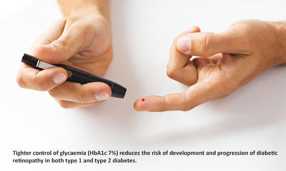  ​reduces the risk of development and progression of diabetic retinopathy in both type 1 and type 2 diabetes.