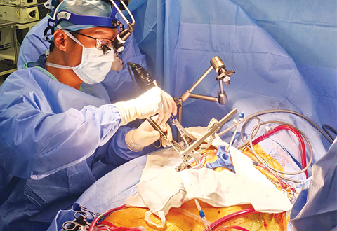  ​Asst Prof Chua Kim Chai performing a minimally invasive cardiac surgery. 
